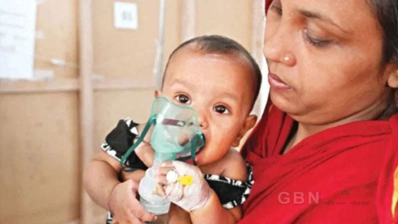 হাম ও হামের উপসর্গে মৃত্যু ১০০০ ছাড়াল