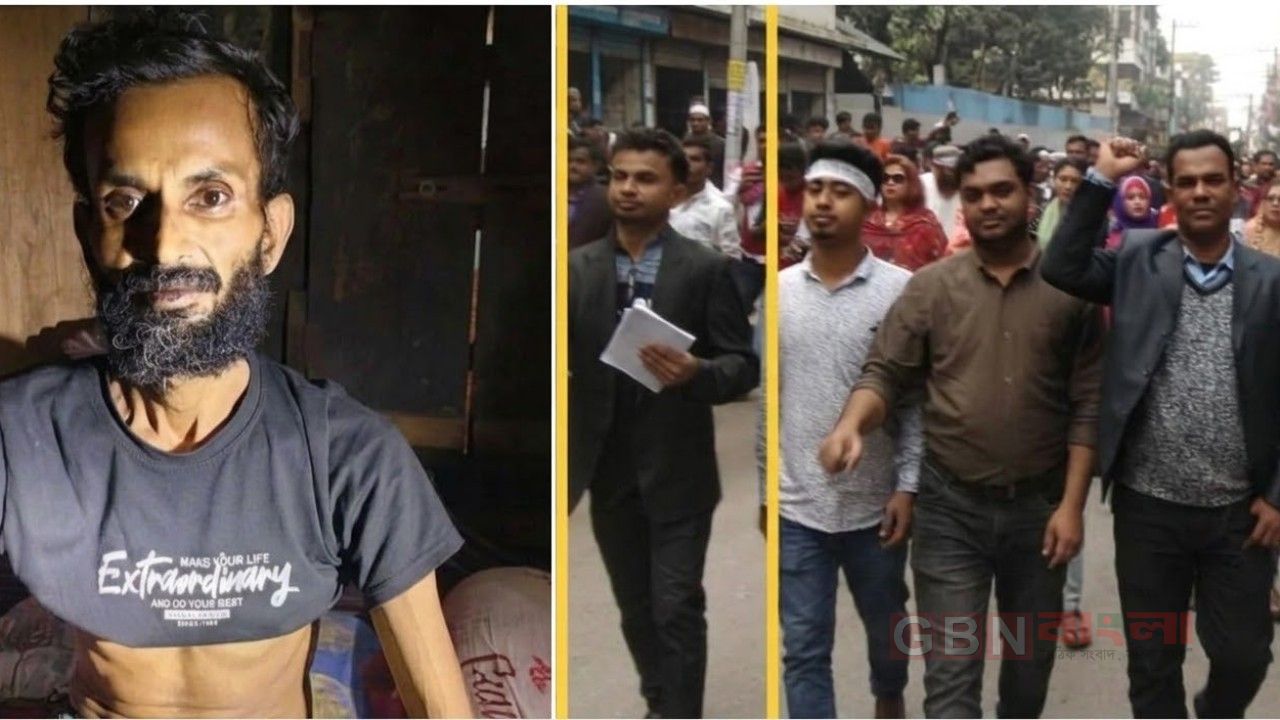 রাজপথের সেই উজ্জ্বল আজ বিছানায়, অর্থাভাবে হচ্ছে না চিকিৎসা